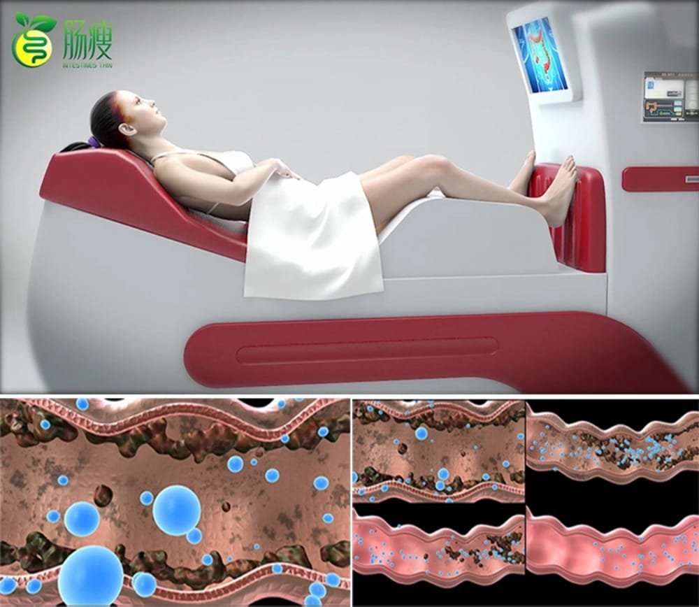 colonic irrigation benefits and risks