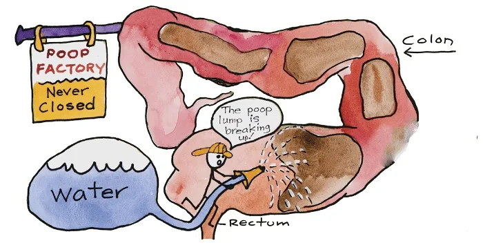 Colon Hydrotherapy Session